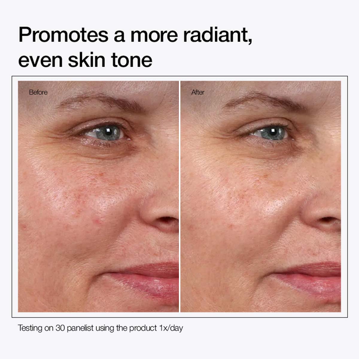 BUY 1 GET 1 FREE / Glycolic Acid 7% Toning Solution